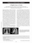 Research paper thumbnail of A Palpable Source of Stroke