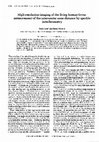 Research paper thumbnail of High-resolution imaging of the living human fovea: measurement of the intercenter cone distance by speckle interferometry