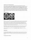 Research paper thumbnail of Temporal Lobe Neurological disorders