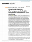 Research paper thumbnail of Biomechanical evaluation of the human mandible after temporomandibular joint replacement under different biting conditions