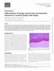 Research paper thumbnail of Differentiation of benign nevoid rests and metastatic melanoma in sentinel lymph node biopsy