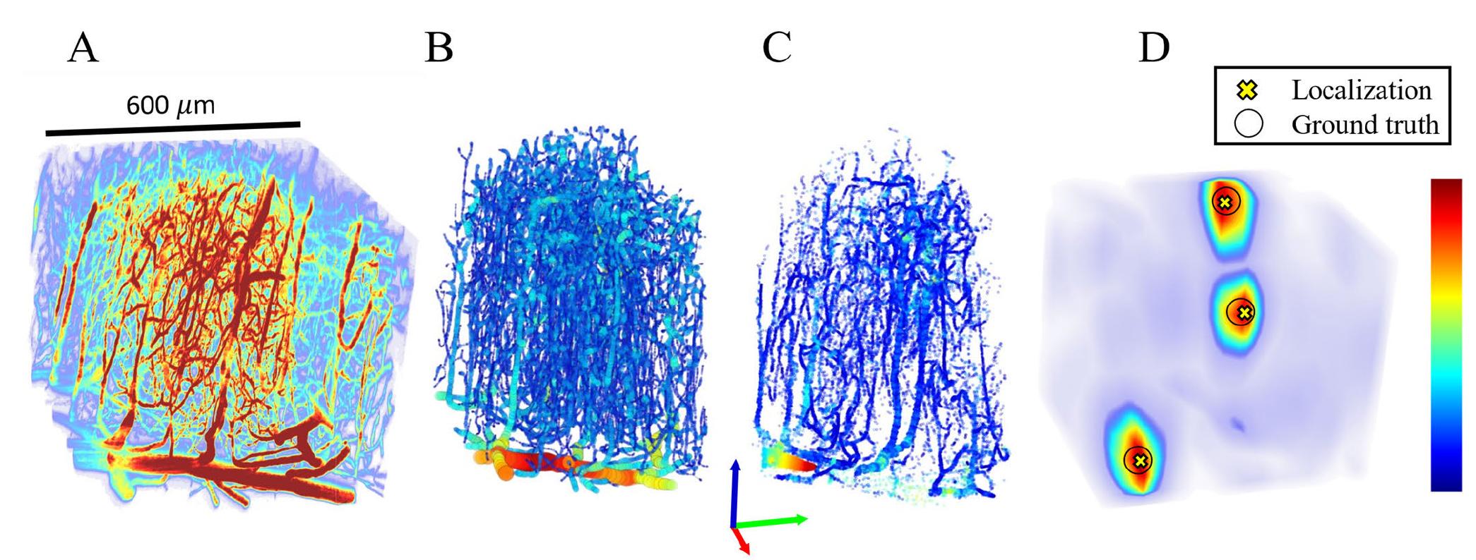 FIGURE 1. Simulation framework. All sub-figures are scaled to match the same scalebar. (A) Two-photon microscopy (2PM) of in-vivo mouse brain is acquired. Colormap represents fluorescence intensity. (B) From the 2PM data, a graph model is generated in  3 stages described in [31]. Colormap represents nodes’ corresponding vessel size. (C) Particle trajectories are generated using the graph model and in-vivo diameter-velocity dependency. Colormap represents MB velocity. (D) Using a GPU-based US simulator,  RF signals are generated and reconstructed to obtain 3D+t US data, on which a correlation-based localization algorithm is applied. Colormap represents the correlation obtained using a spatial convolution of the beamformed PSF and reconstructed in-quadrature  (IQ) data. 