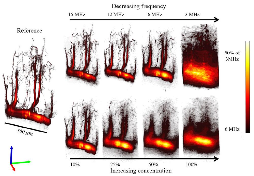 FIGURE 7. MB positions in 6 vascular networks of a mouse brain. (Top) MB flow was simulated with constraints to follo\ in-vivo dependencies: MB count and velocity with respect to the vessel diameter. (Bottom) MB flow was simulated without the MB count (N) vs vessel diameter (d) constraint. Colormap represents normalized velocity in arbitrary units (A.U.). 