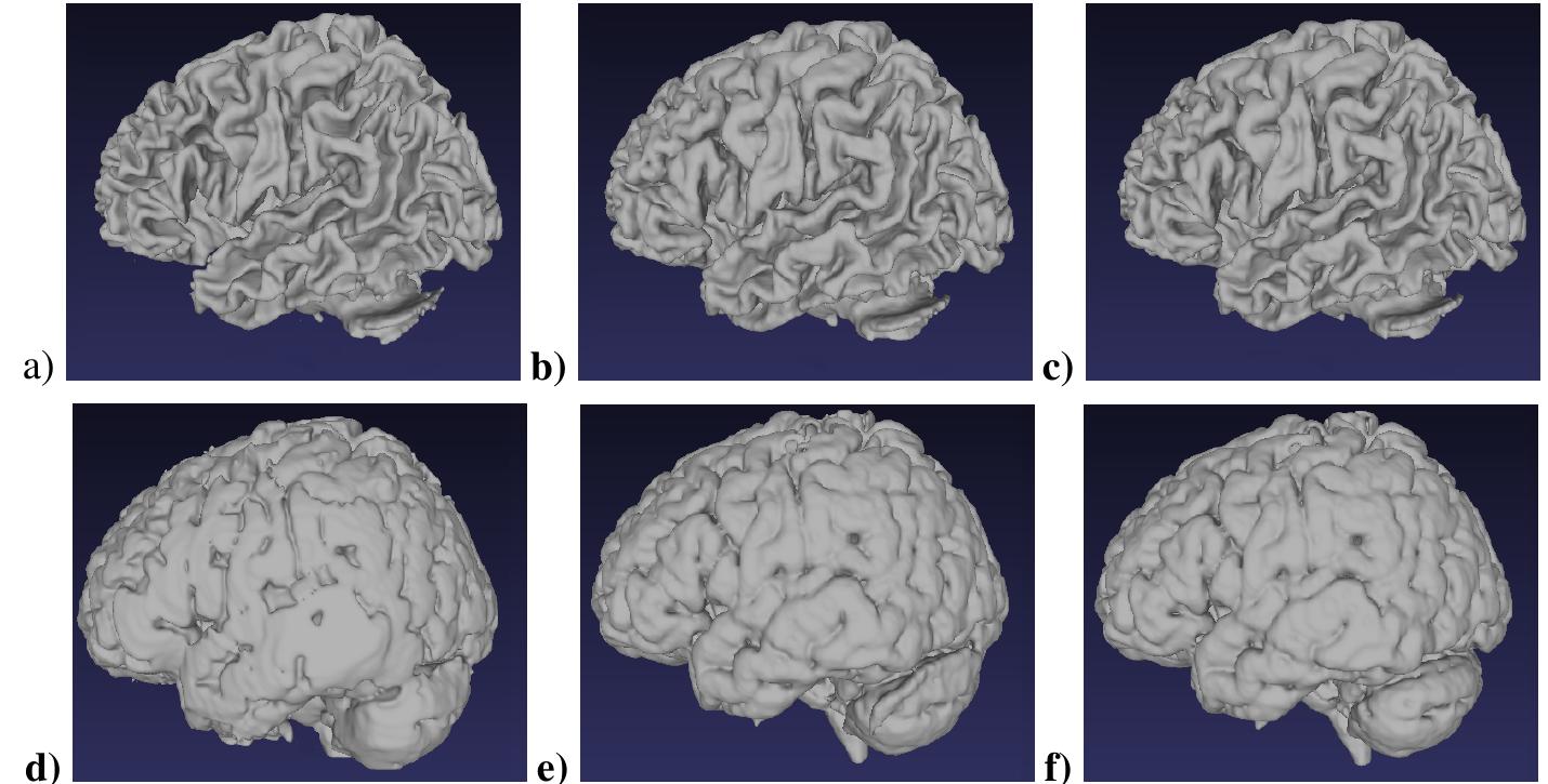 Figure 6. Results for 3D brain MRIs. a) to c) are WM surfaces and d) to f) are GM surfaces of ground truth, Ayman et al.[3] and results obtained by our technique after using median filtering respectively. 
