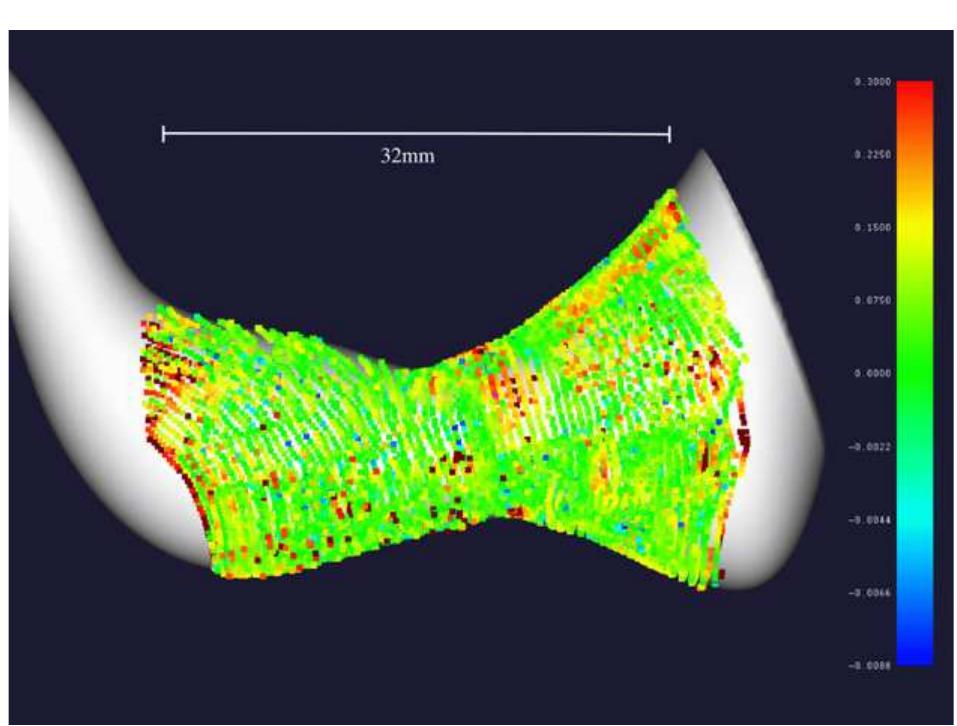 Fig. 15. Measurement result for an artificial cavity. The colors encode the error relative to the ground truth CAD data (mm). The average error was 0.092 mm. (For interpretation of the references to colour in this figure legend, the reader is referred to the web version of this article.) 