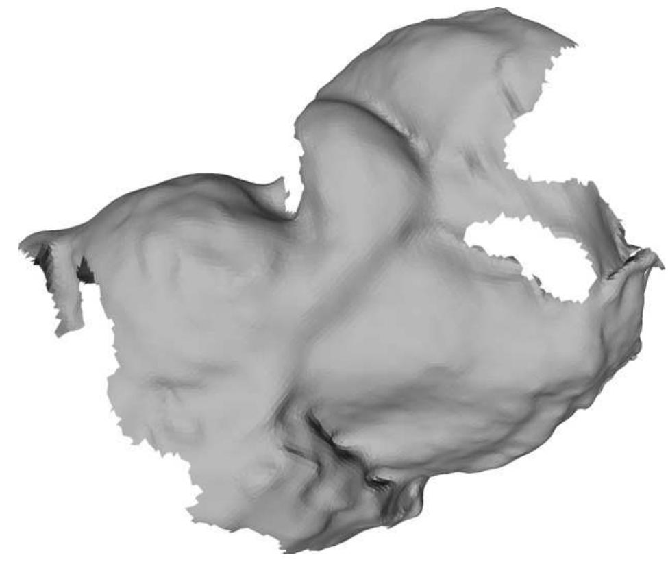 Fig. 17. Colon phantom surface reconstructed from 50 frames. The folds are clearly visible, but also cause shadows which result in holes in the recovered surface.  Fig. 19 shows the measured surface of the windpipe, which has a diameter of approximately 14 mm. The input data consisted of a 
