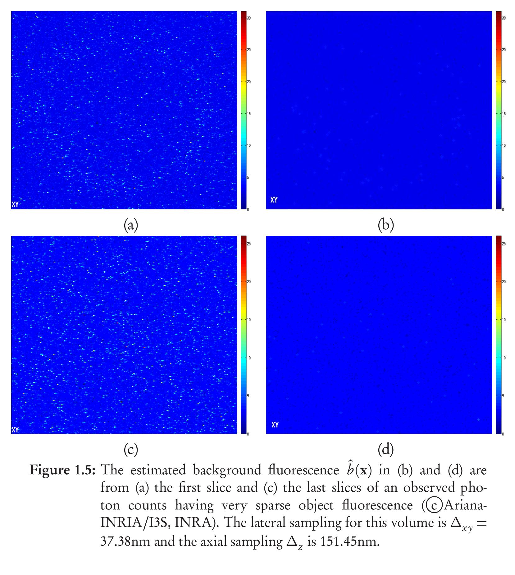 histograms for the observed image volume and the volume after the background was subtracted. When we compare the histograms, we observe how the entire his- togram has been shifted towards the zero after the background subtraction (BS).  What we can also infer from the background estimated section is that there is a  uniformity in the illumination and no alignment problems. The mean value of the background signal from this estimation procedure was found to be about 3.13  IU. Next, the overall histogram of the image volume, in Fig. 1.6, was smoothed  IU. Next, the overall histogram of the image volume, in Fig. 1.6, was smoothed  tribution was estimated to be lie between 3.9683 and 3.9702 IU with a 95% confi- 