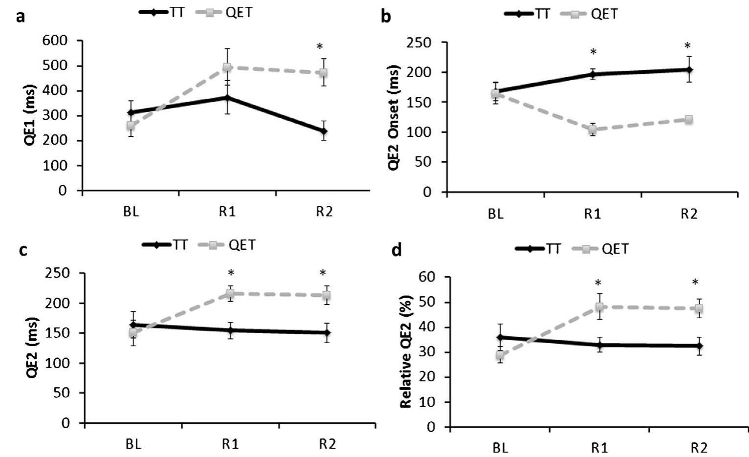Fig. 2. Mean QE1 duration (a), QE2 onset (b), QE2 absolute duration (c) and QE2 relative duration (d) of the QET and TT groups across baseline (BL), immediate retention (R1) and delayed retention (R2) tests (error bars represent S.E.M). 