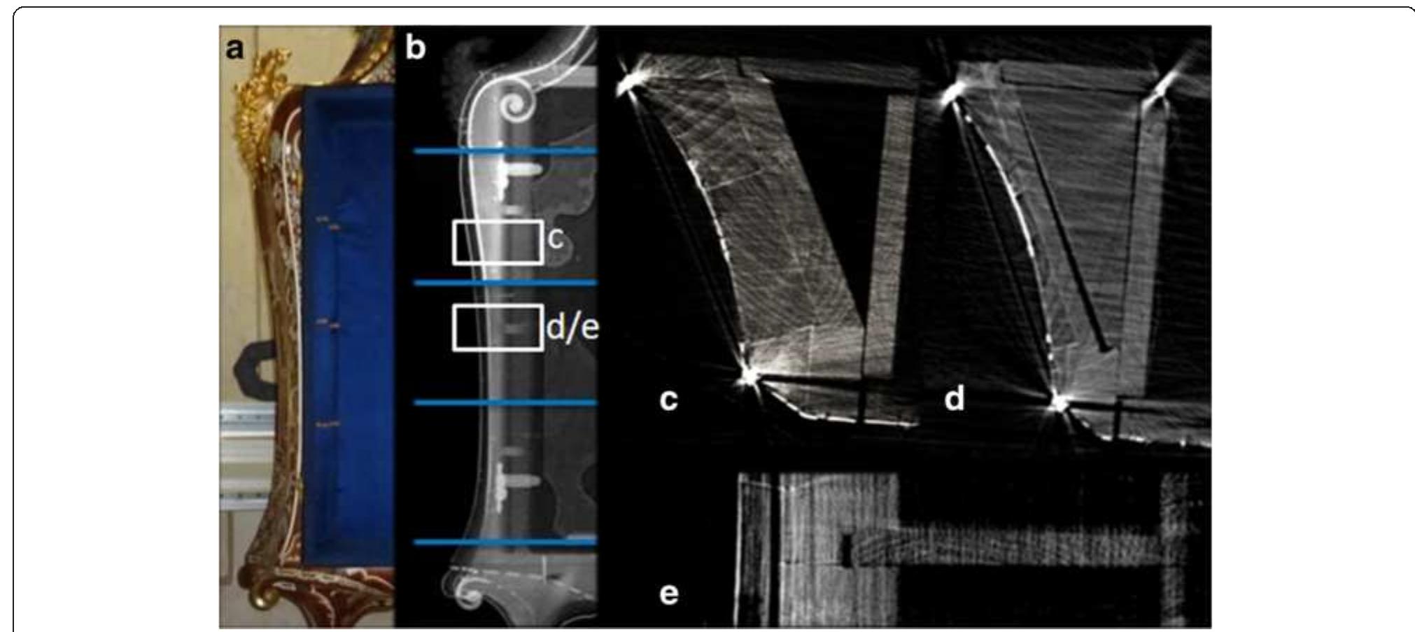 Figure 3 The side of the shelves. (a) the shaped side of the shelves; (b) X-ray radiograph of the same part; CT horizontal section without (c) and with (d) a triangular spacer; (e) CT lateral section of the spacer. 