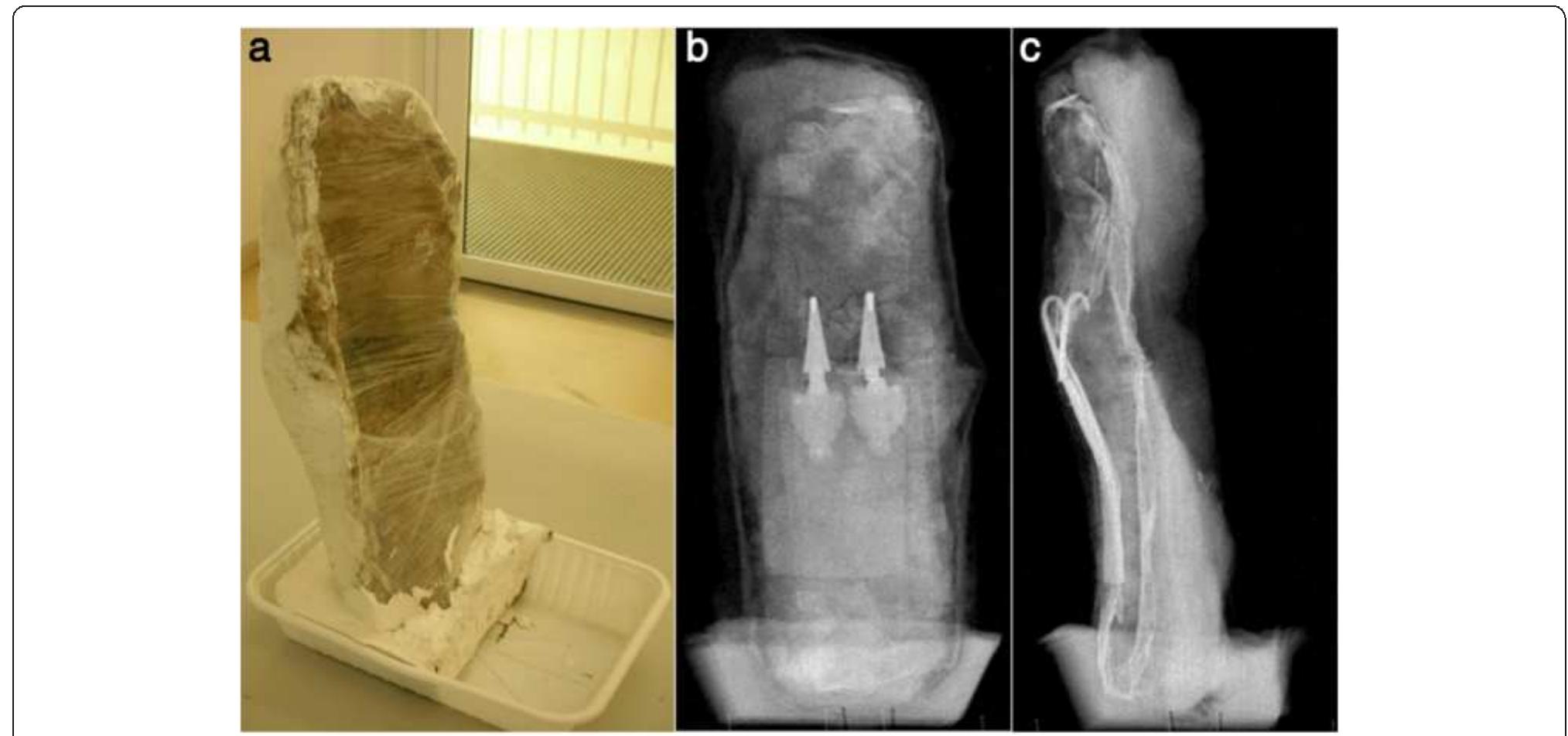 Figure 2 Radiographs. A picture (a) and two radiographs (b-c) of the soil block viewed from different angles. 