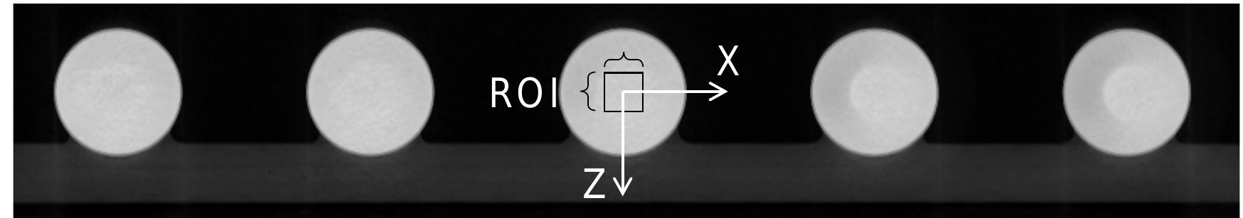 Figure 8: Selection of the ROI for measurements of the SNR. The slice was taken in the XZ plane of the CT scanner’s coordinate system. 