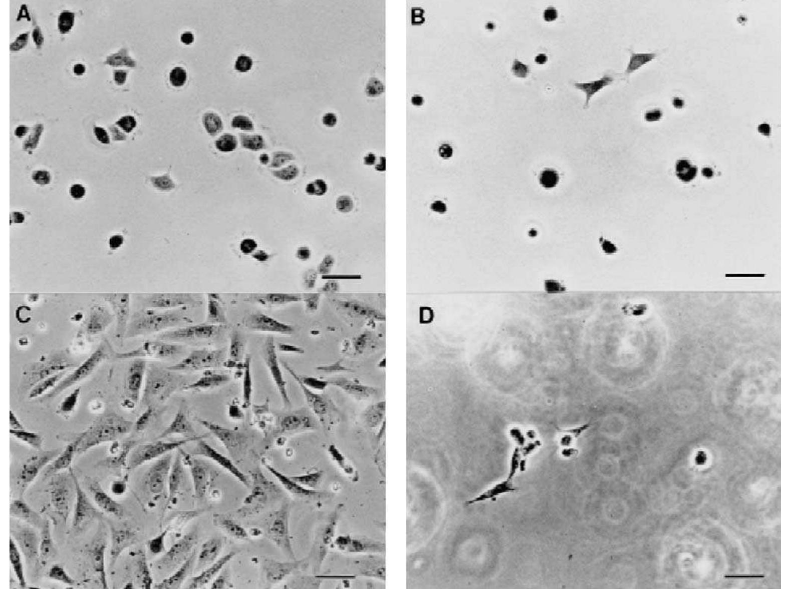 Fig. 40. Osteoblast attachment to PMA and OT SAMs at 90 min (A: MPA, B: OT) and 18 h(C: MPA, D: OT). Bar = 50 wm. Original magnification 180~. (Reprinted from [144] with permissions from Wiley Inter Science.)  Zreiqat et al. [143] investigated the effect of surface chemistry modification of Ti-6Al-4V alloy with zinc, magnesium, and alkoxide-derived hydroxy carbonate apatite (CHAP) on the regulation of key intracellular signaling proteins in human bone-derived cells (HBDC) cultured on these modified surfaces. An ion beam implantation technique was used to modify the surface of Ti-6Al-4V with Zn and Mg and a sol gel coating technique was used to deposit alkoxide-derived hydroxy carbo- nate apatite on the surface of Ti-6Al-4V. SEM images (Fig. 38) [143] of HBDC cultured on the three different surfaces for 1, 2, and  The various phenomena that may occur at the interface after implantation of a biomaterial into a living system are sequential and is schematically shown in Fig. 41. Initially the proteins respond to the implant surface and form a thin layer of protein film on the 