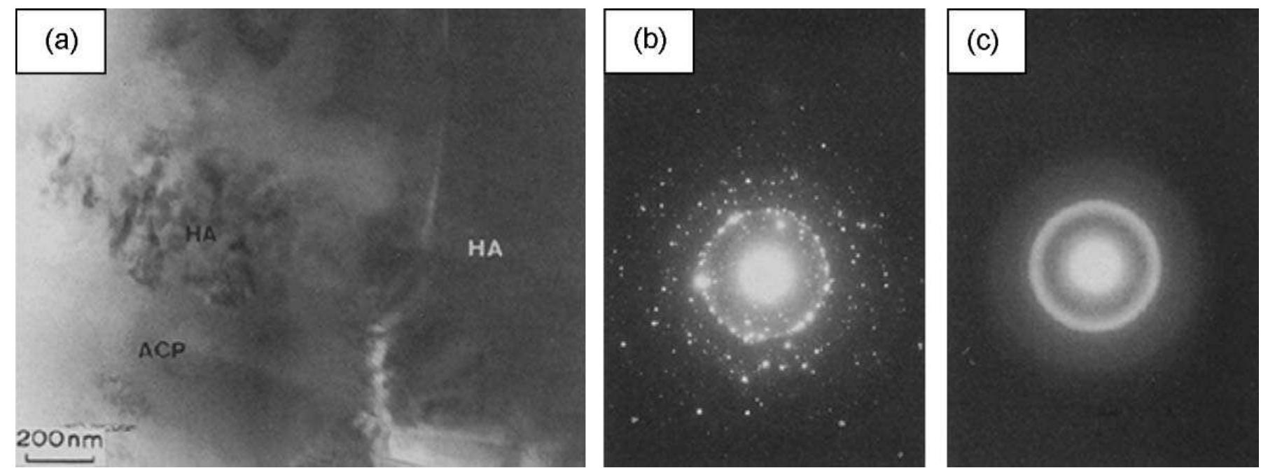 Fig. 72. (a)TEM micrograph taken from hydroxyapatite coatings show crystalline phases within amorphous phase. (b) A selected area diffraction pattern from the crystalline phase showing a ring pattern consistent with a polycrystalline structure. (c) A selected area diffraction pattern taken showing diffuse rings from the amorphous phase. (HA crystalline hydroxyapatite, (ACP) amorphous calcium phosphate. (Reprinted from [208] with permissions from Springer.) 