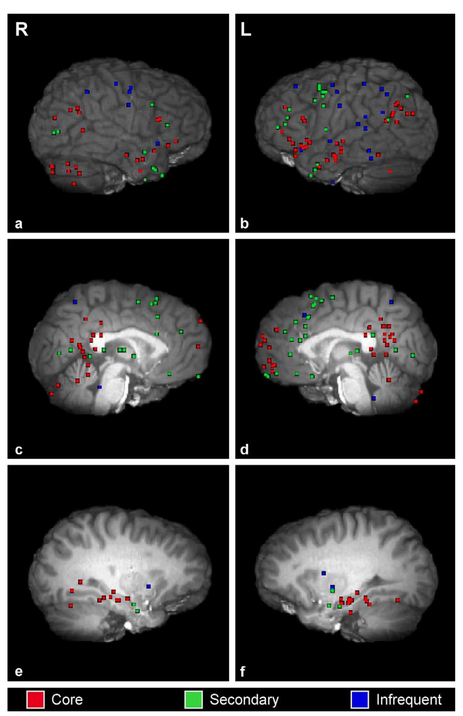 Fig. 1. Significant peaks of activation reported across imaging studies of AM. Activations in core, secondary and infrequently reported regions are depicted acros right (left column) and left (right column) lateral, medial and lateral subcortical planes. 
