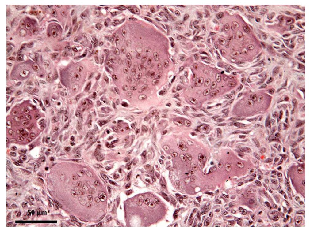 Fig. 5. Photomicrograph of the irregularly shaped MGCs, containing abundant eosinophilic cytoplasm and numerous nuclei arranged centrally in an overlapping fashion. Goldner’s trichrome. 
