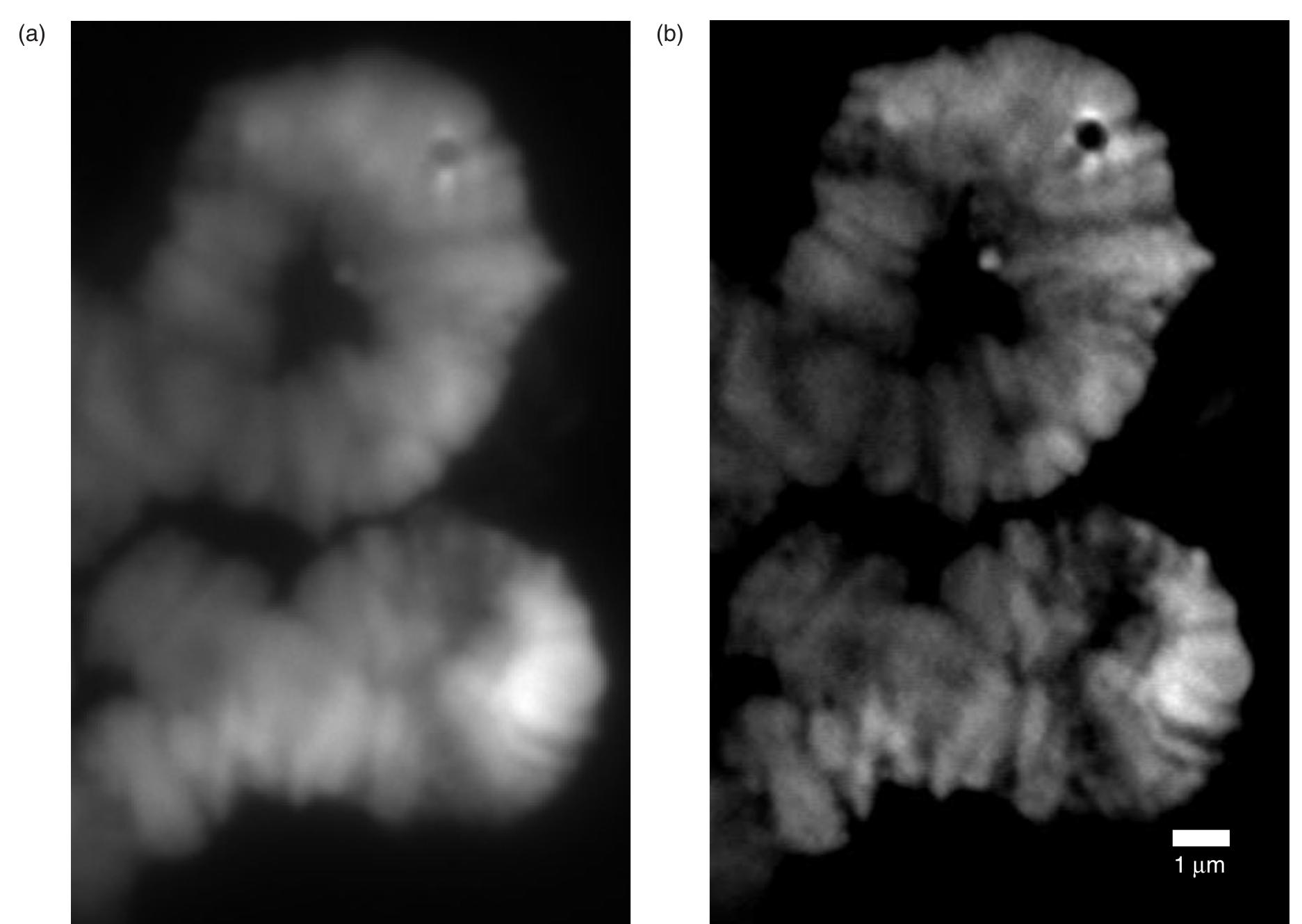 Figure 4: Linear structured illumination of Drosophila Polytene chromosomes stained with Sytox Green (a) Widefield image obtained by summing all the individual images under structured illumination. (b) Reconstruction of the sample from the structured illumination data (5 phases, 2 angles). 