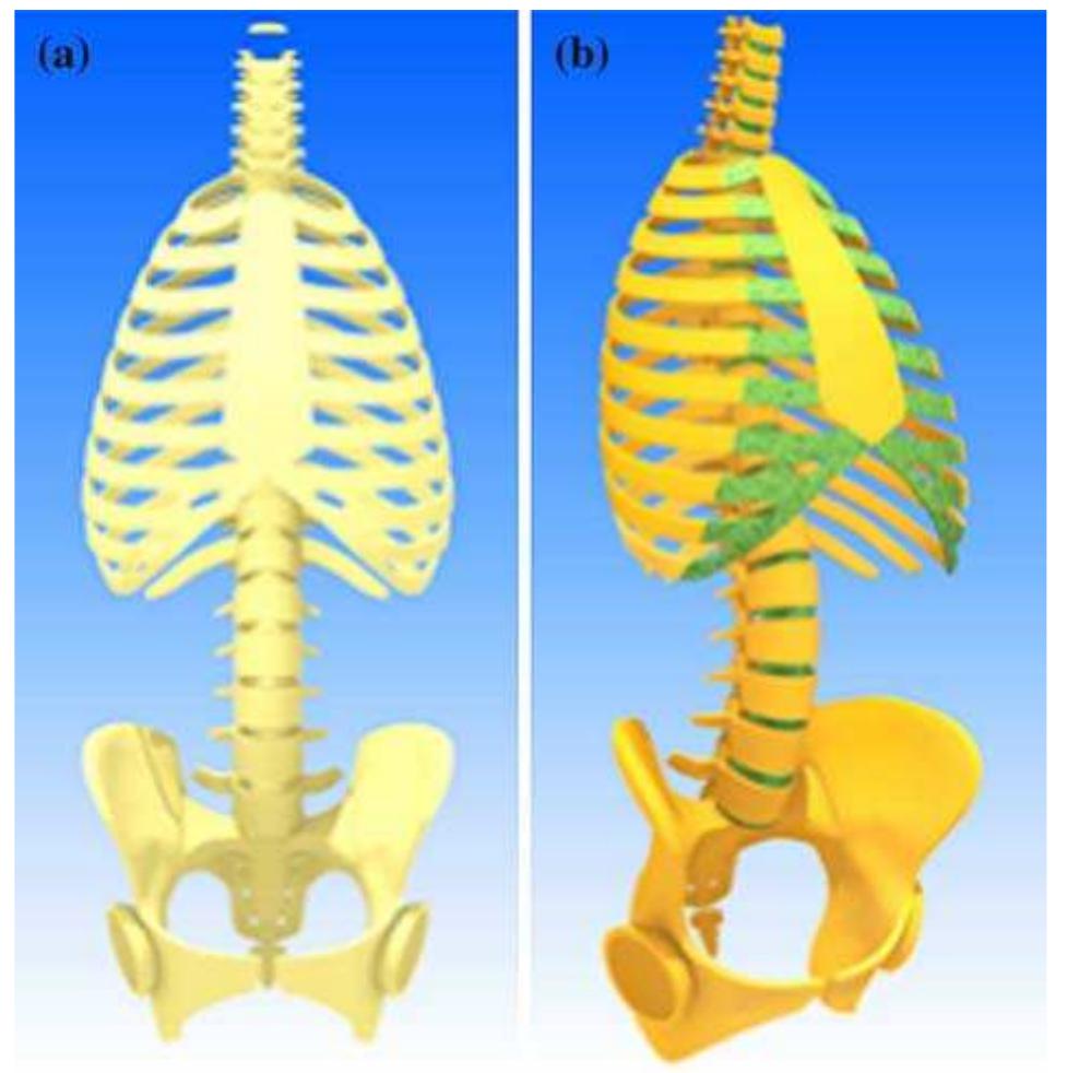 Figure 2. Relationship between the ability to recognize a simple anatomical form within a more complex frame. “The anterior surface of the costal cartilages is convex and looks forward and upward, each costal cartilage presenting 2 surfaces, 2 borders and 2 extremi- ties”. To indicate whether such an affirmation is true or false, the student may have to identify and disembed the “costal cartilage form” from the background of the complex figure (a), as shown by figure (b)