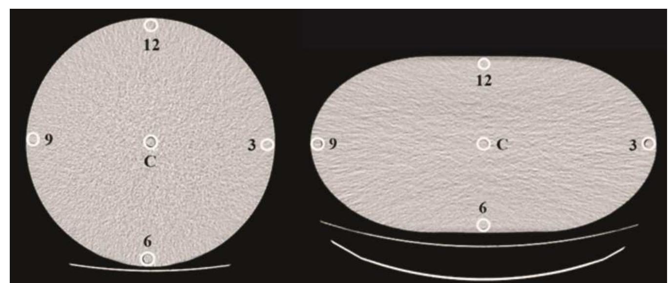 Figure 4.- Axial image of the central slice of the cylindrical and oblong phantoms, with the  September 24 to 28", 2016. Tuxtla Gutiérrez, Chiapas. México. 