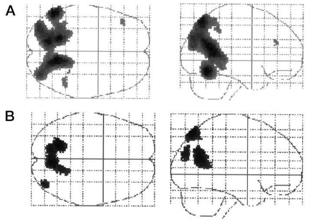 Figure 4. A, Main effect of memory type displayed on a glass brain to show all areas of significant activation. Areas of increased rCBF during topographical memory compared with nontopographical memory. B, Main effect of sequencing displayed on a glass brain. Areas of increased activity when sequencing was required for correct memory recall are  compared with memory recall for which no particular sequence of infor- mation was necessary. 
