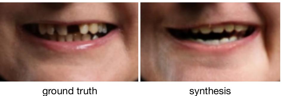 Fig. 18. The ground truth mouth interior is missing a tooth, but network synthesizes a full suite of teeth. 
