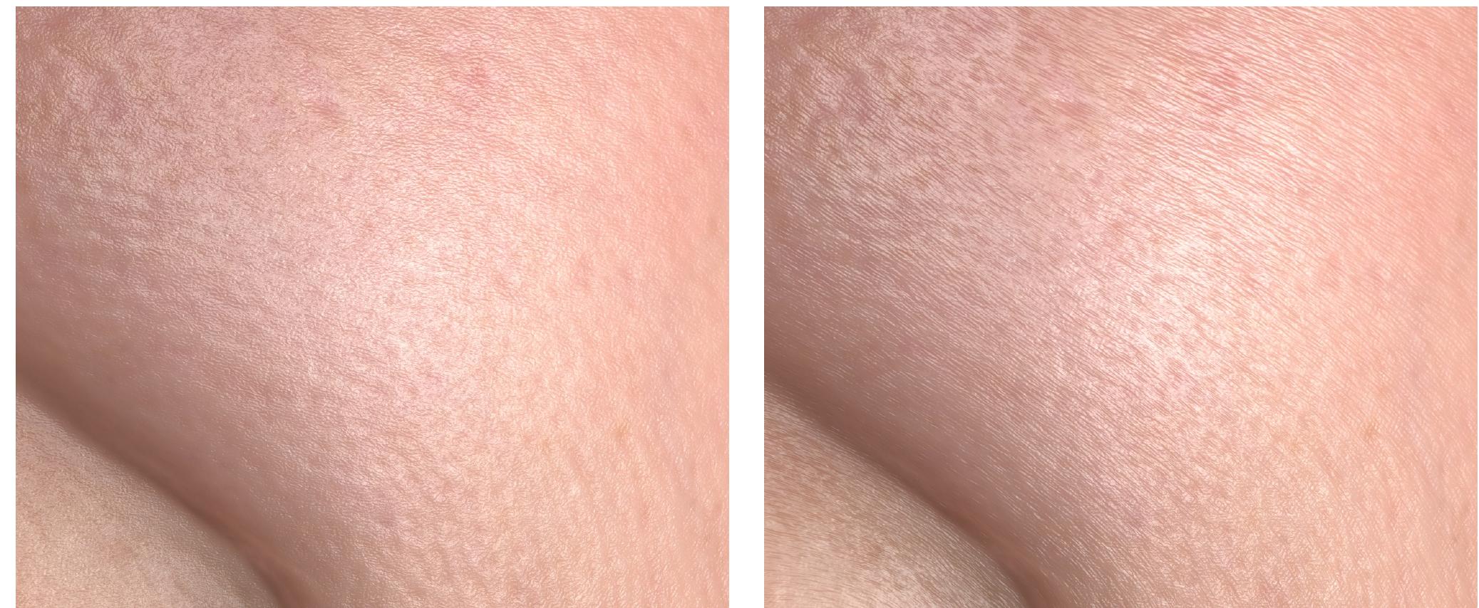Figure 15: Real-time rendering of the cheek region from a facial performance animation with enhanced dynamic surface details (right compared to the static microstructure rendering (left). The dynamic microstructure provides an additional indication of the deformation o1 the cheek when the subject makes a smile expression. 