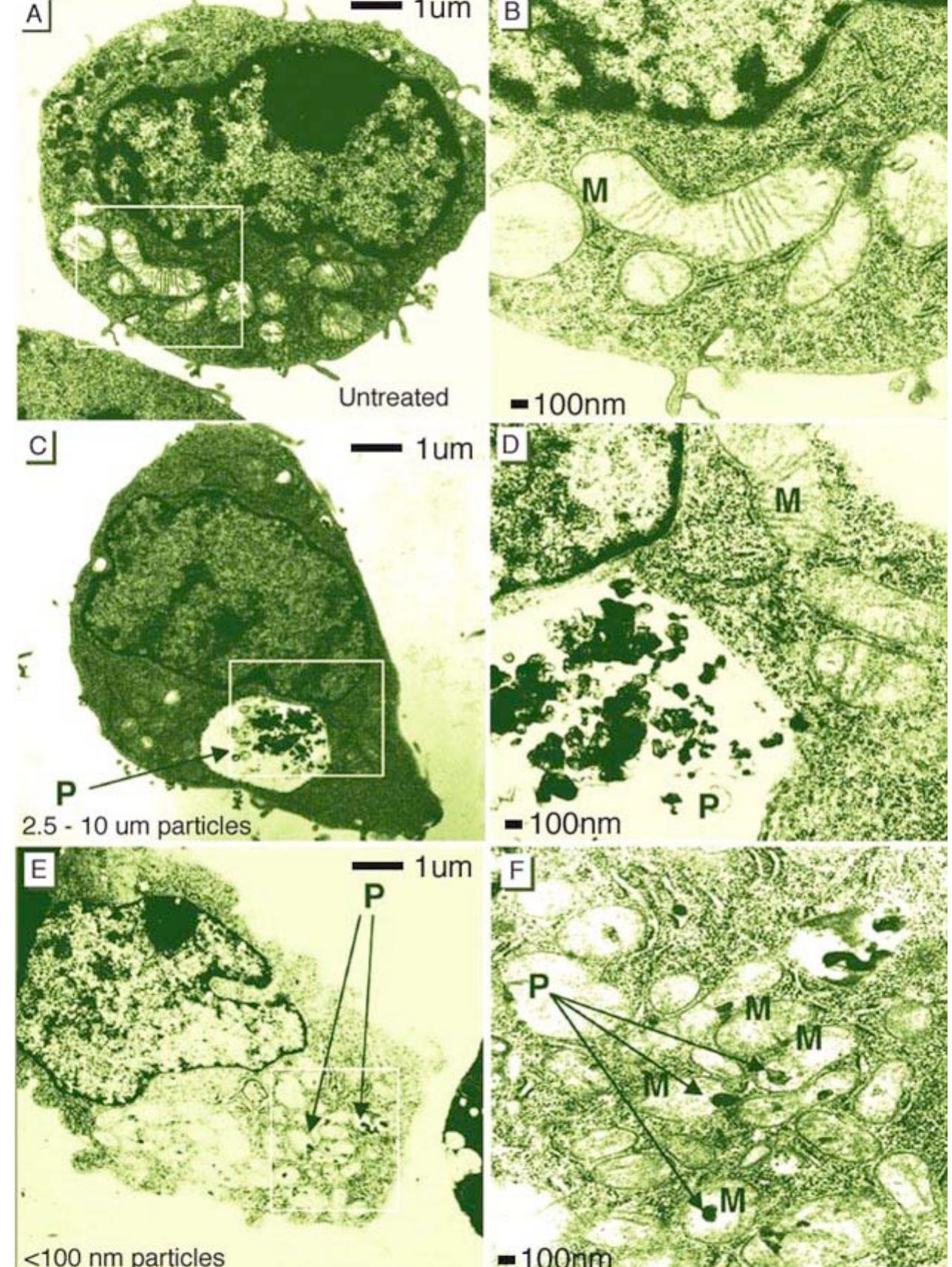 Figure 28. TEM images showing effects of environmental particles size (P) on murine macrophage cell RAW 264.7 treated with various size particles: (a,b) untreated, (c,d) 2.5 - 10 um size particles, (e, particles smaller than 100 nm. M denotes mitochondria [57]. Reproduced with permission fro1 Environmental Health Perspectives.  ES oe eS ee  Particle internalization location depends on nanoparticle size. For example, environmental particles with size between 2.5 - 10 um were found to collect in large cytoplasmic vacuoles (Figure 28 c, d), while smaller nanoparticles (<100 nm) localize in organelles, such as mitochondria (Figure 28 e, f), leading to disruption of mitochondrial architecture [57]. Very small nanoparticles, such as Ceo molecules with a diameter of 0.7 nm, are able to penetrate cells via a different mechanism than phagocytosis, probably through ion channels or via pores in the cell membrane [214]. 