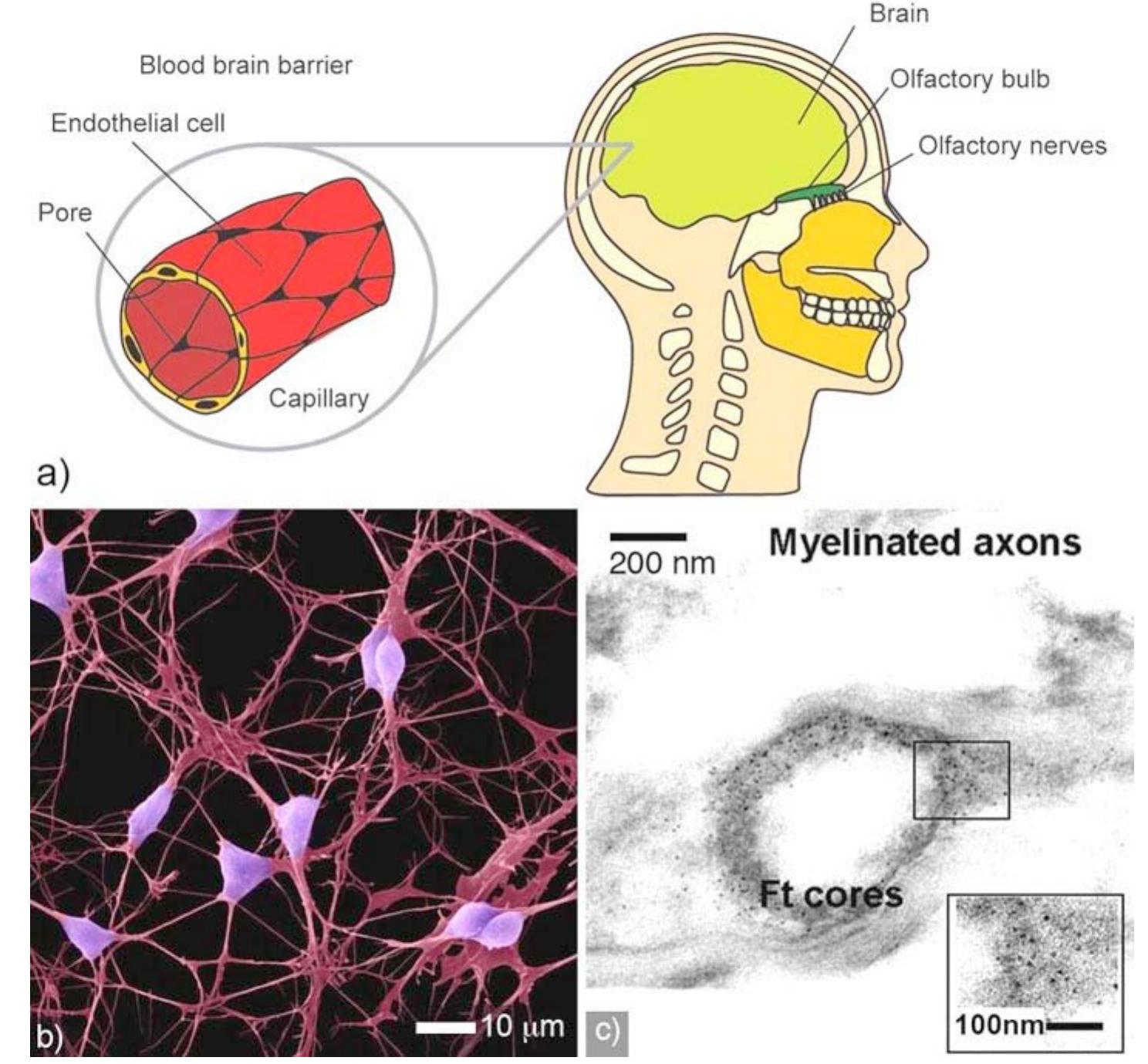 Figure 31. (a) Schematics of the nanoparticles neuronal uptake via olfactory bulb and blood-brain barrier. (b) Cortical neurons (nerve cells) growing in culture. Neurons have a large cell body with several long processes extending from it, usually one thick axon and several thinner dendrites. The axon carries nerve impulses away from the neuron. Its branching ends make contacts with other neurons and with muscles or glands. © Dr. Dennis Kunkel / Visuals Unlimited. Reproduced with permission from Visuals Unlimited [25]. (¢) TEM images of iron accumulation in the brain of neurologically affected  patients. Iron is stored in ferittin, Ft, a protein involved in excess iron storage [171]. Reproduced with permission from Elsevier.  The nervous system is composed of the brain, spinal cord, and nerves that connect the brain and spinal cord to the rest of the body. In addition to nanoparticle uptake due to inhalation (discussed below), nervous system uptake may occur via other pathways (such as dermal). Uptake via olfactory nerves and the blood-brain-barrier are the most studied pathways. 