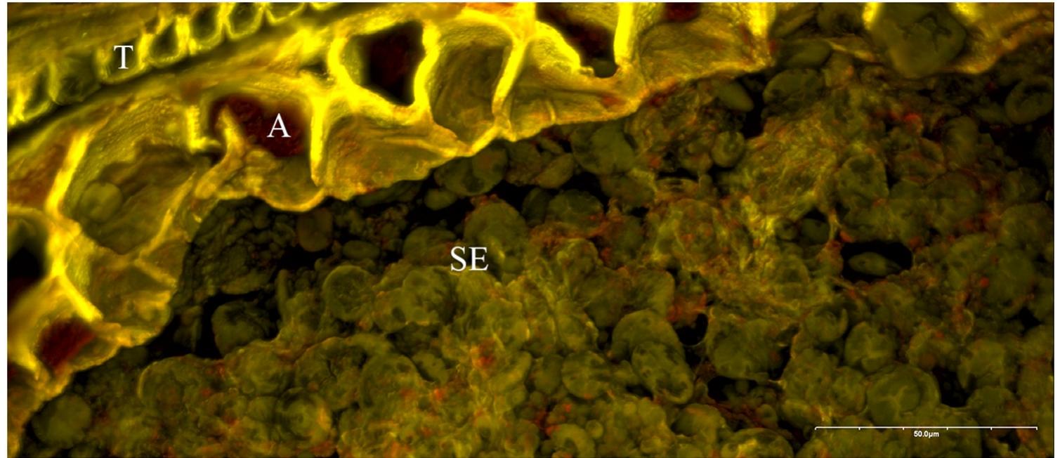 Fig 3. Bread wheat (Triticum aestivum) grain after six days of sprouting. SE. . . starchy endosperm, A. . . aleurone. T. .. transverse cells. Fluorescence (CLSM) colours: yellow = cell walls, red = proteins, green = starch. Image: TUM-Weihenstephan / J. Helbing.   It may be due to the lack of practical relevance for modern brewing that these observations on aleurone cell wall degradation have not received much attention beyond plant physiological and brewing technology research. Neither has this knowledge ever been transferred to the archaeo- logical sciences. Aleurone cell wall thinning could definitely be a very promising marker for malt- ing and, while only indirectly pointing towards beer, might prove highly useful for researchers of ancient beer. Not for all types of beer, as must be admitted. Beer types entirely basing on unmalted grains cannot be detected via aleurone cell wall thinning, because microbial fermenta- tion itself has no impact on cell wall thickness: Wild types of true yeasts do not display notable cellulase or xylanase activity [24, 114], and neither do wild LAB or AAB strains [115-119]. A few  