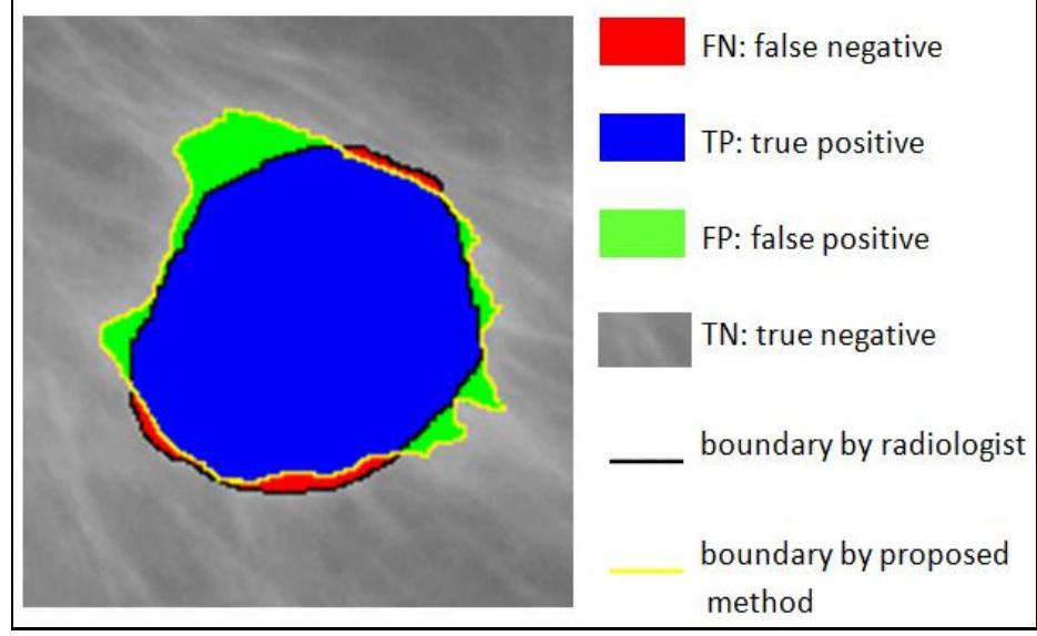Figure 2. True positive, false positive, true negative and false negative definition
