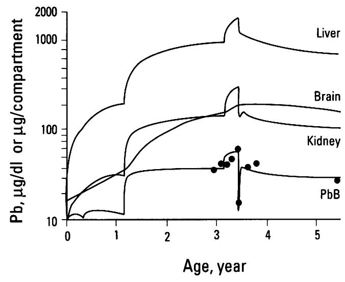 Figure 8. ICRP model-predicted for blood and tissue Pb levels and PbB observations in a child receiving chela- tion treatment for Pb poisoning. Data are the observed PbB (@) and the curves are ICRP model-predicted PbB (ug Pb/dl) and soft tissue Pb content (total jg Pb/tis- sue) from birth to 5.5 years of age. 