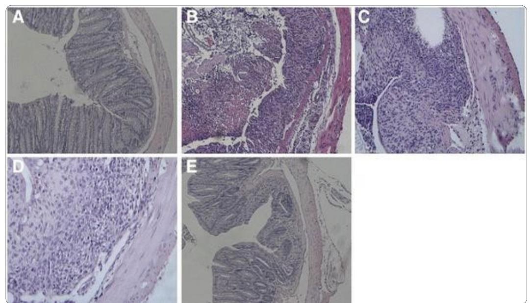 Figure 1. Untreated colon (control), inflamed colon upon induced colitis and colon upon DSS treatment.  group that does not have colitis. These results and images support CM cells derived from mesenchymal amniotic stem cells have potential therapeutic uses for the treatment of inflammatory bowel diseases such as Crohn's Disease and Colitis [4]. 