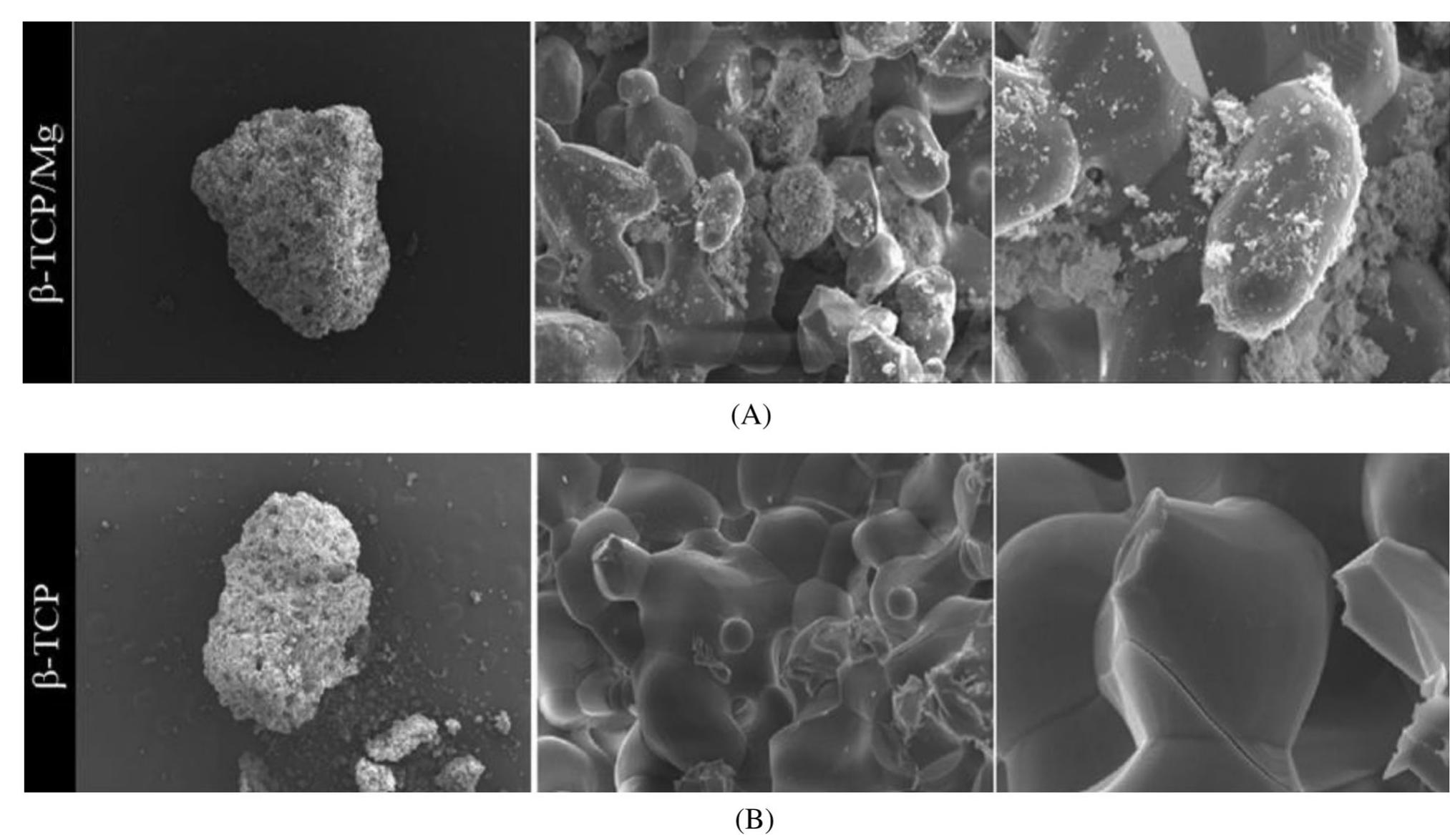 FIGURE 18 Scanning electron microscope images of the 6-TCP surface showed the effect of adding MgO on enhancing bone regeneration (A) -TCP/Mg apparent fusion of MgO ions with the 6-TCP surface is observed, (B) 8-TCP control. Adopted from [146] 