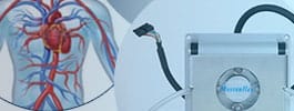 CES-casestudy-pad-treatment-heart.jpg CES-casestudy-pad-treatment-heart.jpg
