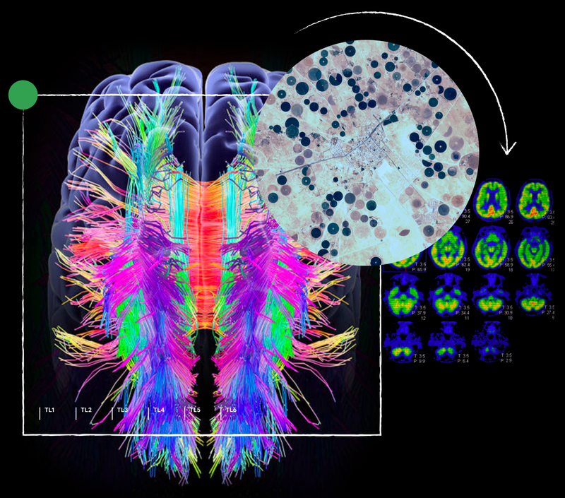 Brain imagery